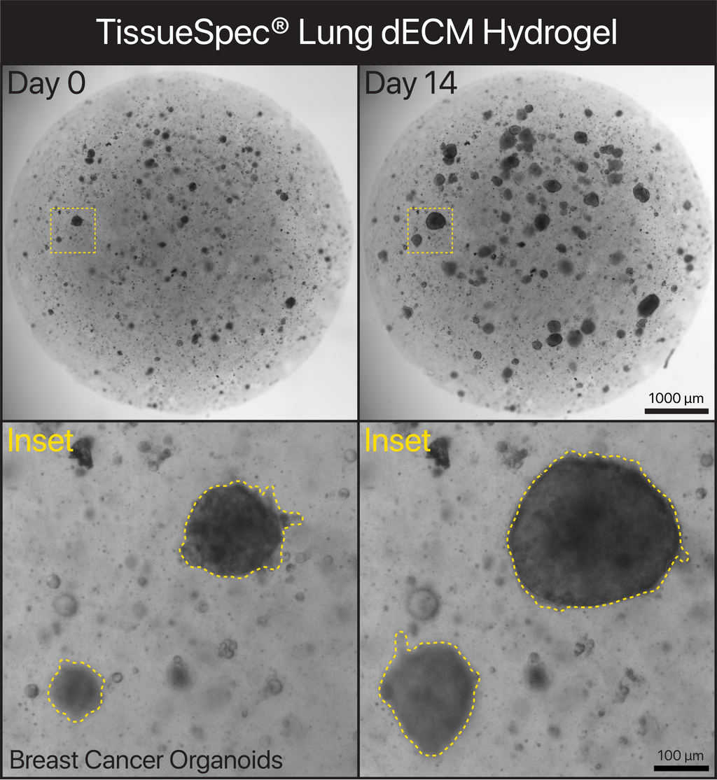 TissueSpec® Multi-Organ Metastasis dECM Hydrogel Kit: Sustained cell culture of breast cancer organoids embedded in TissueSpec® Lung dECM Hydrogel