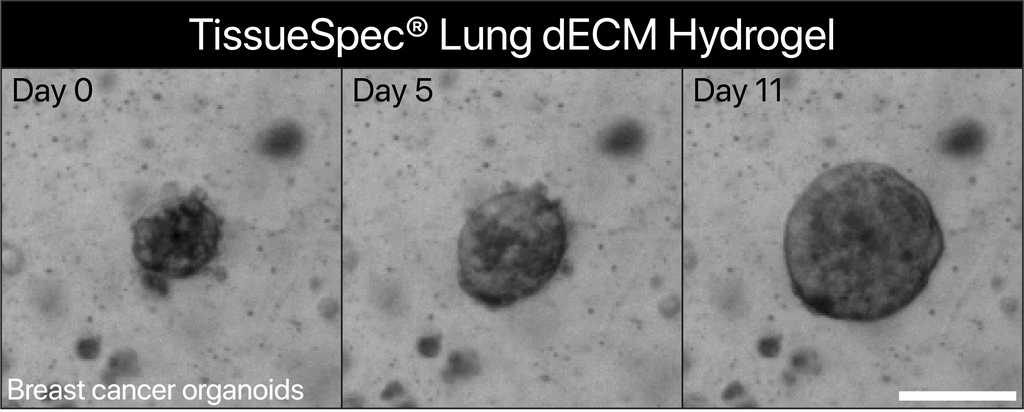 TissueSpec® Lung dECM Hydrogel Kit: Breast cancer organoids cultured in TissueSpec® Lung dECM hydrogel