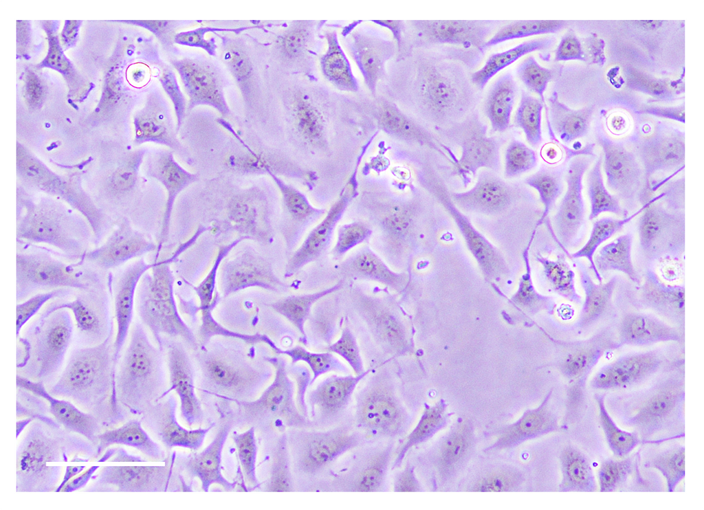 TissueSpec® Bone dECM Coating Kit: Morphology of lung adenocarcinoma cells.