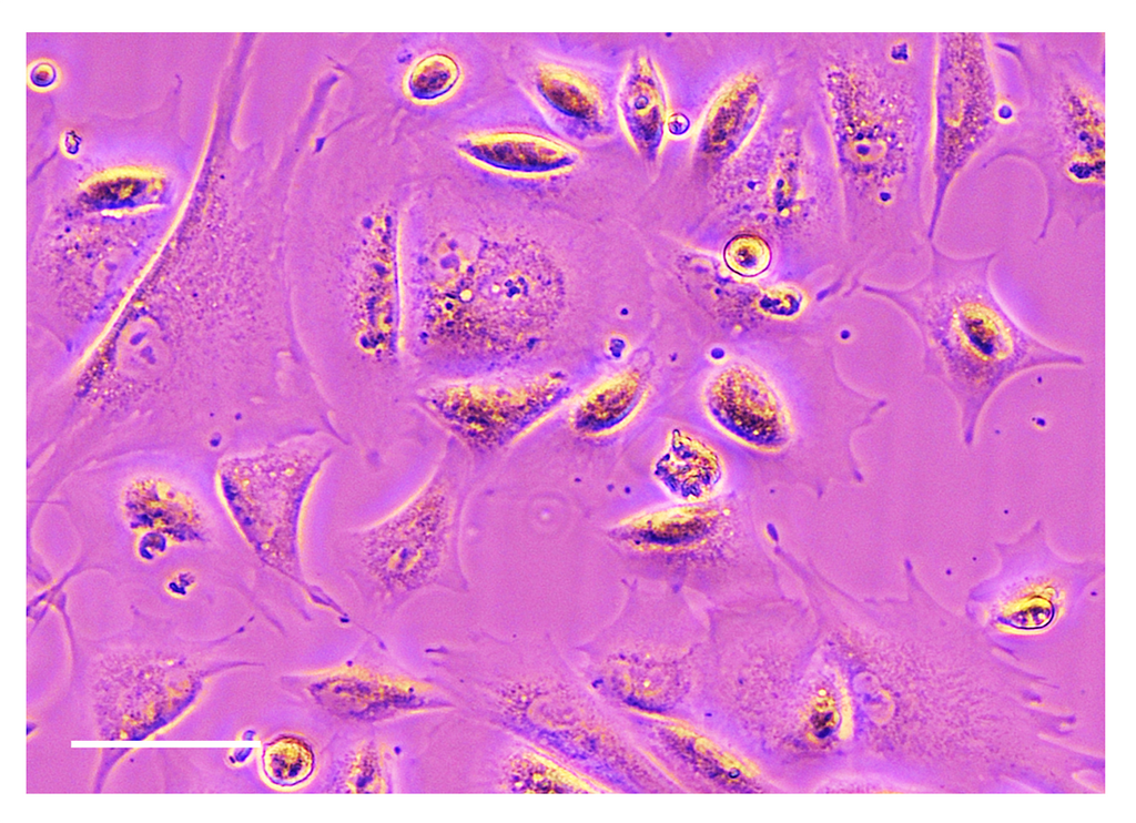 TissueSpec® Bone dECM Coating Kit: Morphology of primary human osteoblasts.