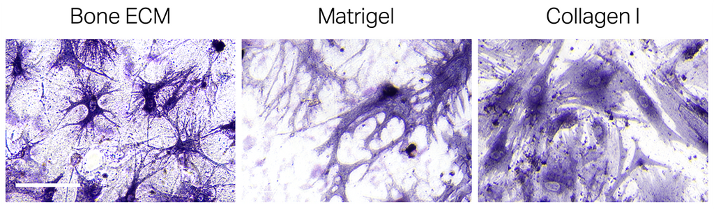 TissueSpec® Bone dECM Hydrogel Kit: Alkaline phosphatase activity of primary human osteoblasts.