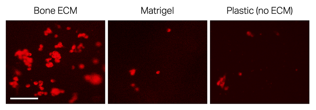 TissueSpec® Bone dECM Hydrogel Kit: Migration (Boyden chamber) assay.