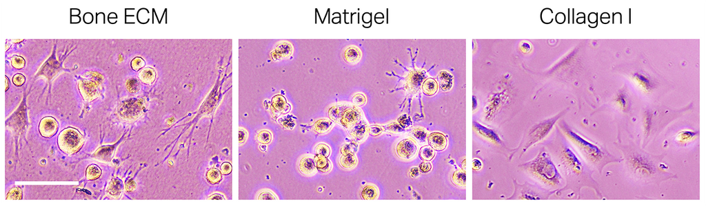 TissueSpec® Bone dECM Hydrogel Kit: Morphology of primary human osteoblasts.