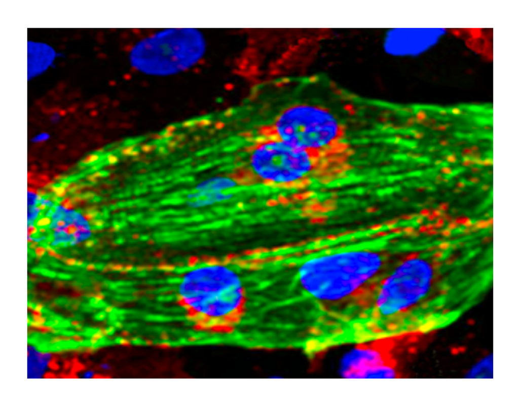 TissueSpec® Heart dECM Hydrogel Kit: Immunostaining human embryonic stem cell-derived cardiomyocytes.