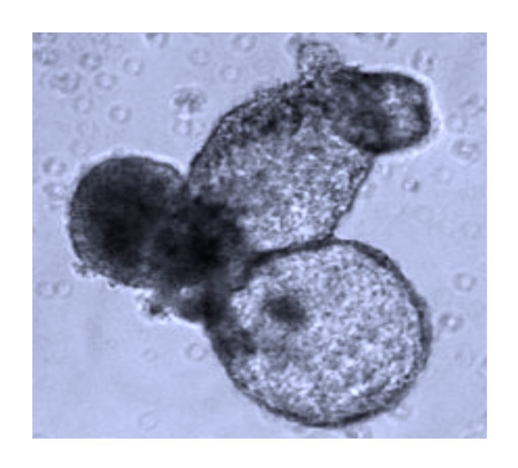 TissueSpec® Heart dECM Hydrogel Kit: Morphology of embryoid bodies.