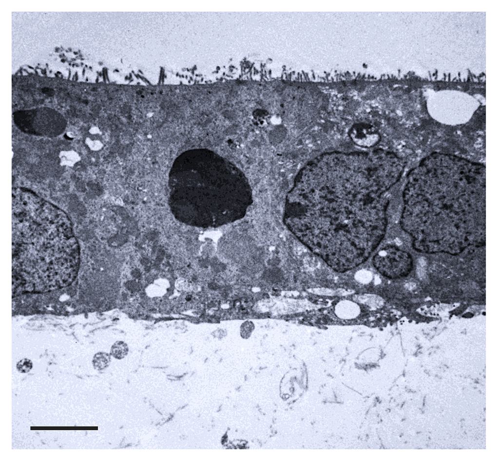 TissueSpec® Intestine dECM Hydrogel Kit: primary human colon carcinoma (Caco-2) cells cultured in TissueSpec® Intestine dECM Hydrogel.