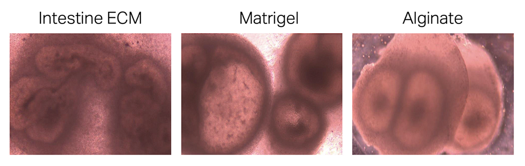 TissueSpec® Intestine dECM Hydrogel Kit: human intestinal organoids.