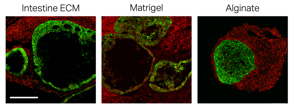 TissueSpec® Intestine dECM Hydrogel: human intestinal organoids cultured in TissueSpec® Intestine dECM Hydrogel, Matrigel, and alginate.