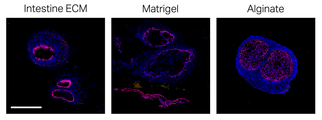 TissueSpec® Intestine dECM Hydrogel Kit: human intestinal organoids cultured in TissueSpec® Intestine dECM Hydrogel, Matrigel, and alginate.