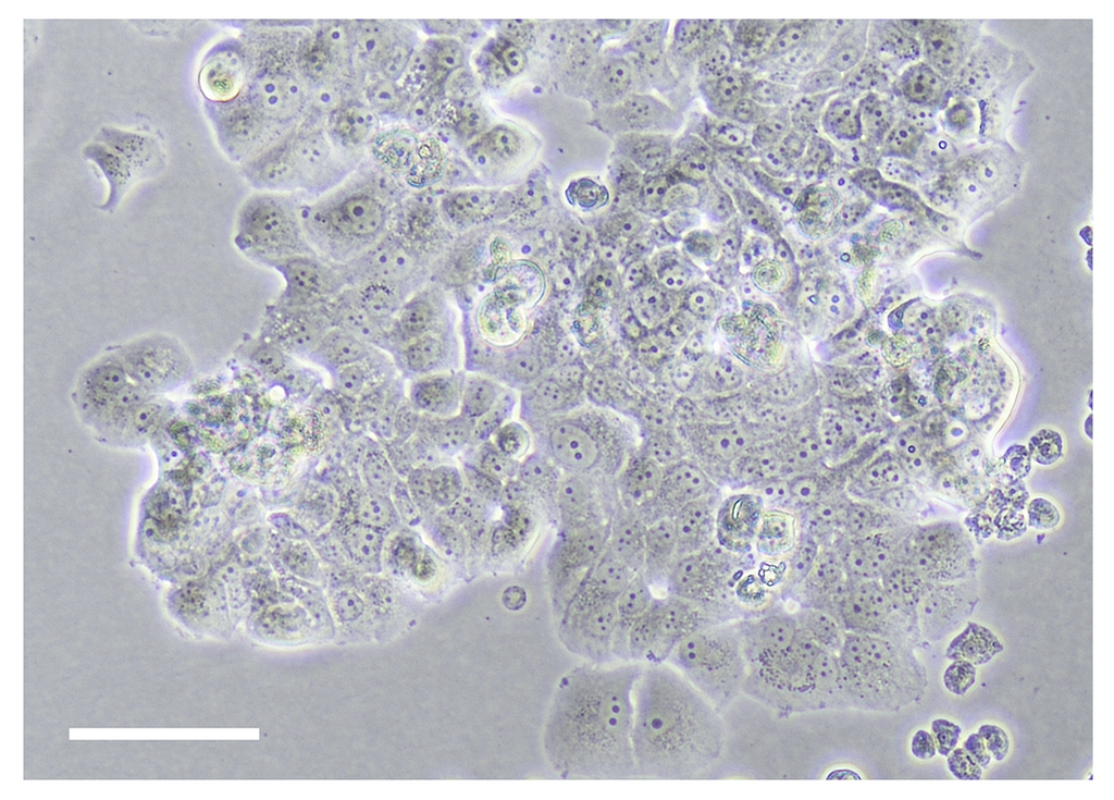 TissueSpec® Lung dECM Coating Kit: Morphology of breast cancer cells.