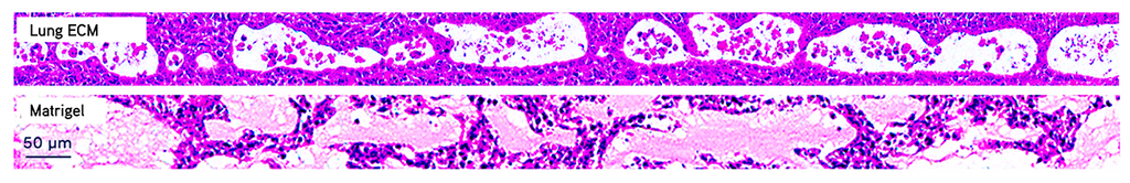 TissueSpec® Lung dECM Hydrogel Kit: Luminal formation.