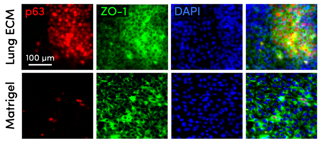 TissueSpec® Lung dECM Hydrogel Kit: Primary normal human bronchial epithelial cells.