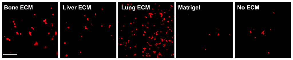 TissueSpec® Multi-Organ Metastasis dECM Hydrogel Kit: Migration (Boyden chamber) assay of BT-549 breast cancer cells.