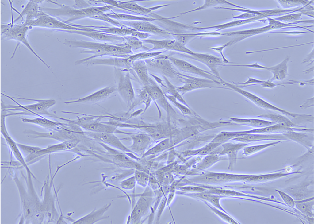TissueSpec® Skin dECM Coating Kit: Morphology of normal dermal fibroblasts.