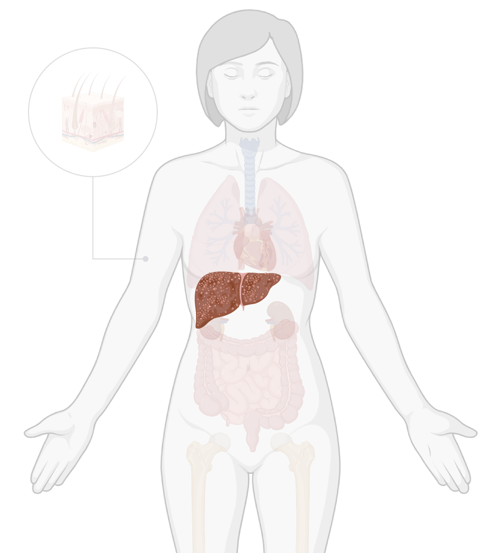 TissueSpec® Human Liver Fibrotic dECM Coating Kit