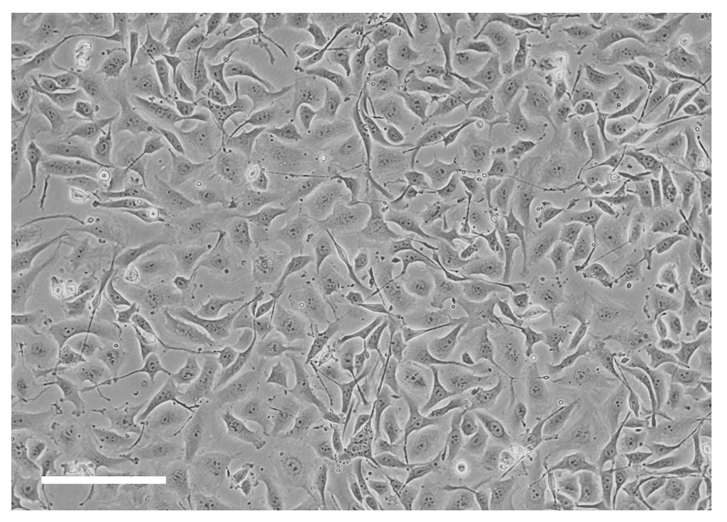 TissueSpec® Lung dECM Coating Kit: Morphology of lung adenocarcinoma cells.