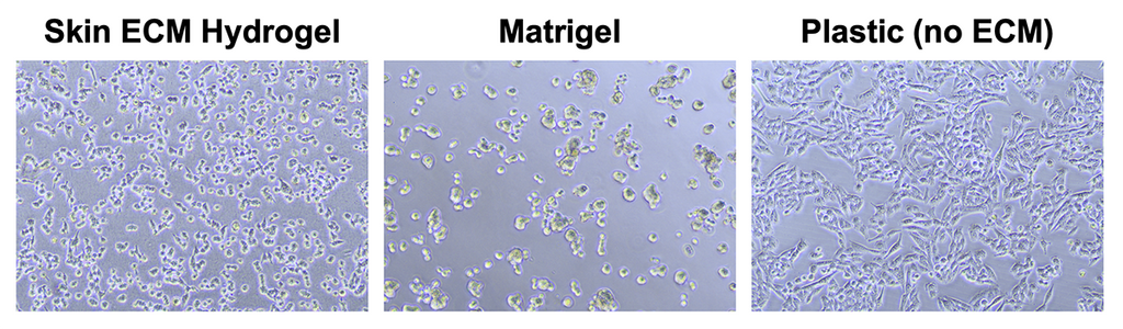 TissueSpec® Skin dECM Hydrogel Kit: Morphology of melanoma cells (A375).